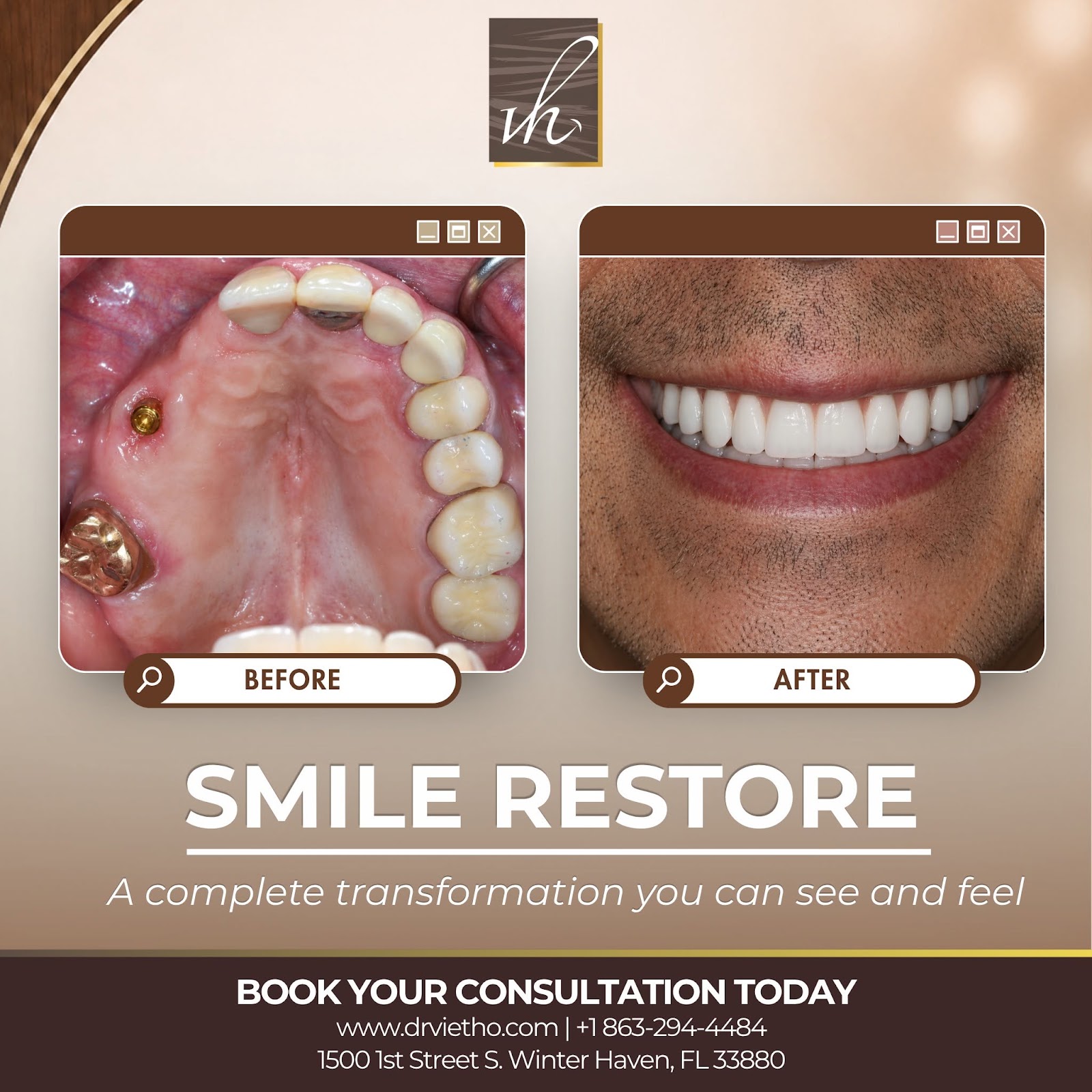 Case 2 Before and After