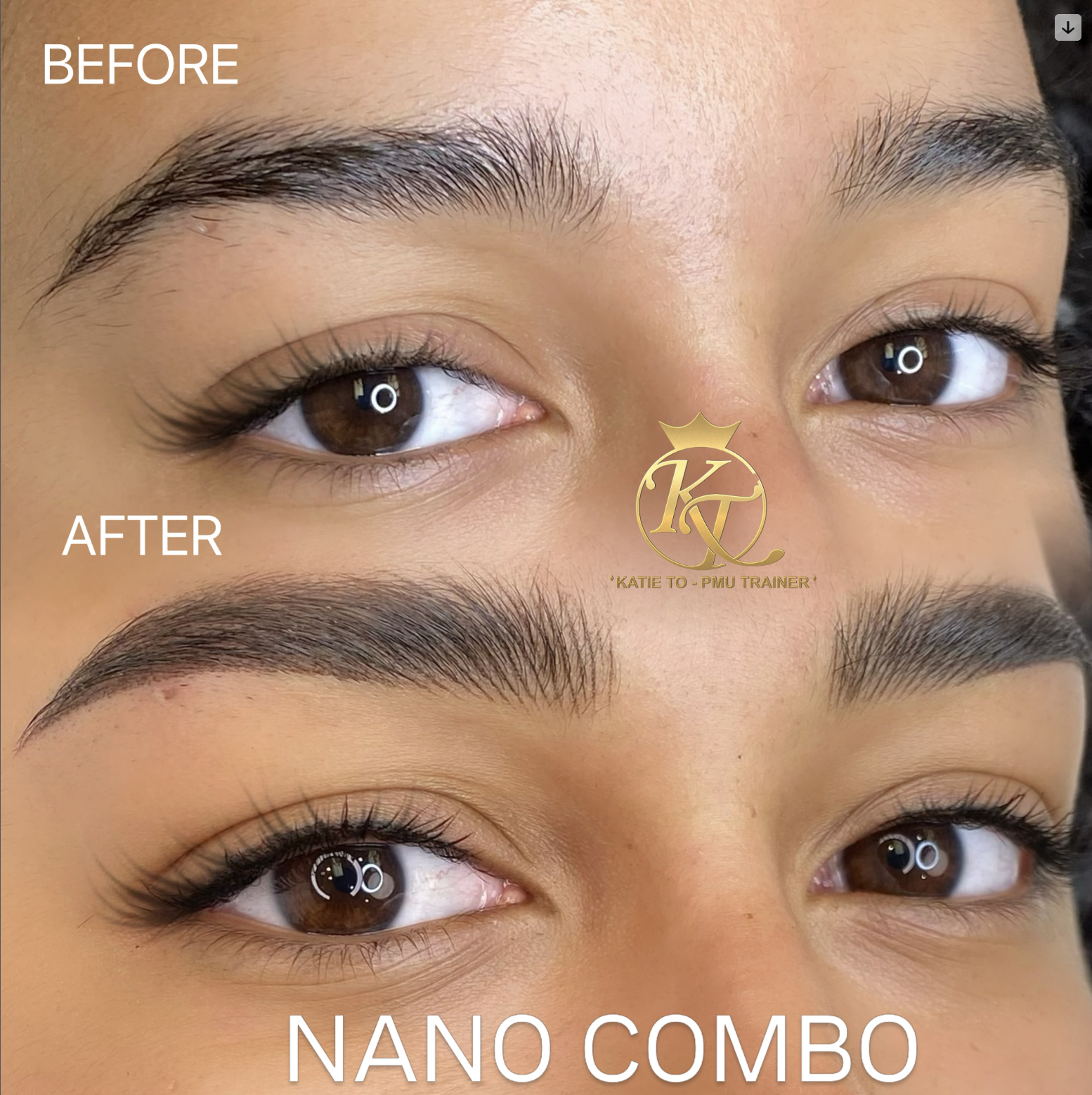 Brow result