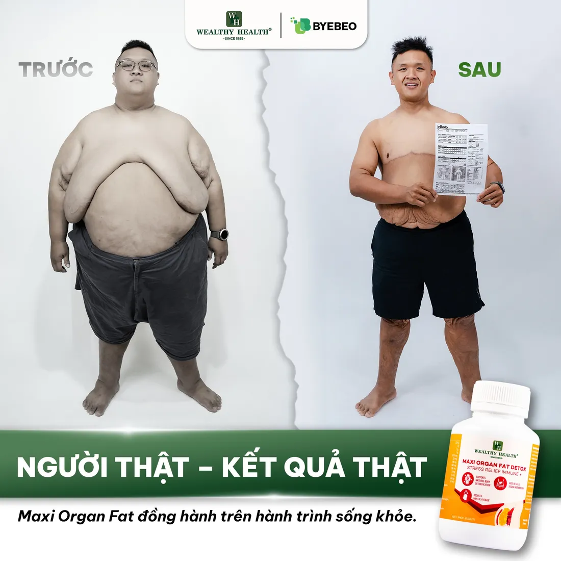 Hình ảnh hành trình sống khỏe cùng Maxi Organ Fat Detox