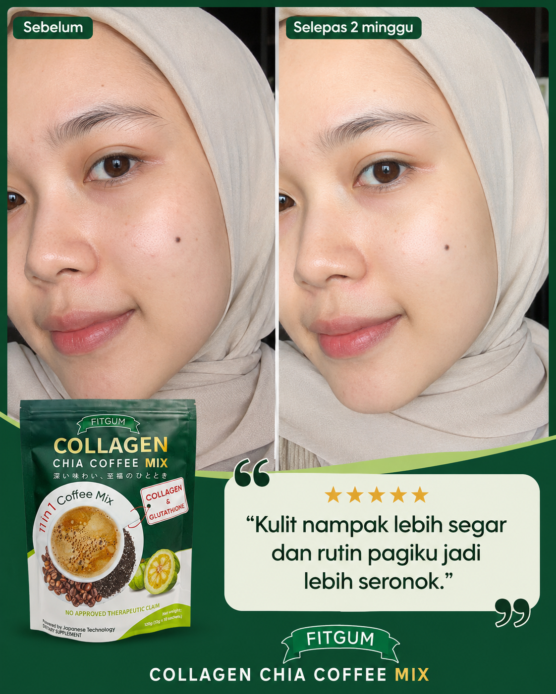 Feedback FITGUM 4