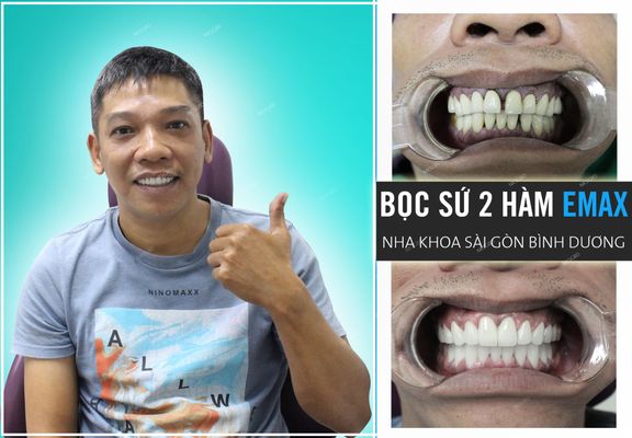 z1561258575955 c4b4560856b6fa1581f6a8ee8970dfbd 20200430031910
