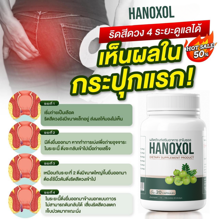 Hanoxol: ผลิตภัณฑ์จากธรรมชาติสำหรับคนที่ต้องการรักษาริดสีดวงทวารอย่างได้ผล