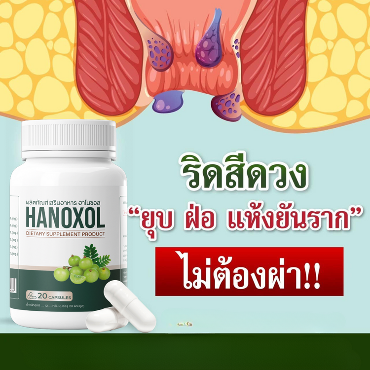 Hanoxol – ผลิตภัณฑ์เสริมอาหารที่ช่วยป้องกันและรักษาริดสีดวงทวาร