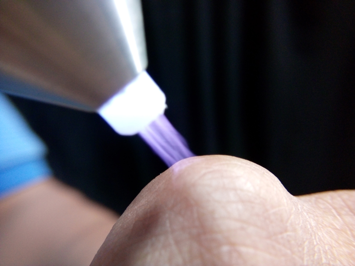 Bước 6: Chiếu Plasma lạnh